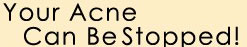 Acne Fighting Website